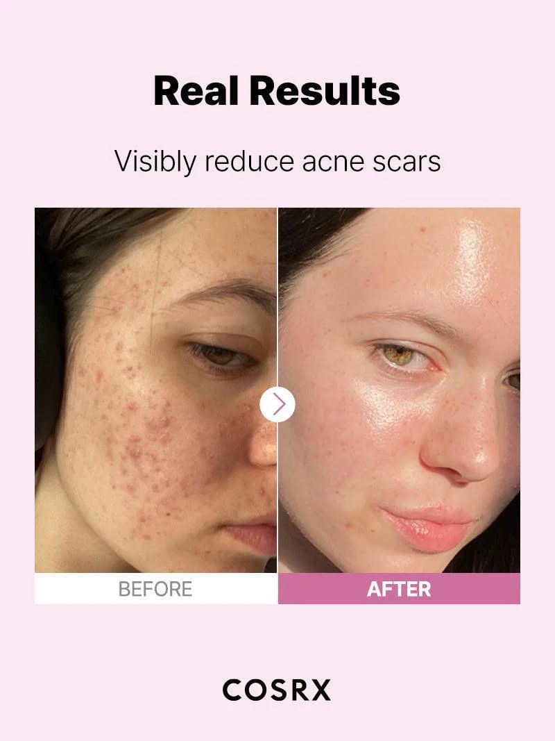 COSRX 15% Niacinamide Face Serum 20ML
