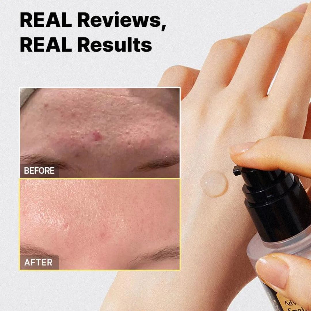COSRX Advanced Snail 96 Mucin Power Essence 100ML