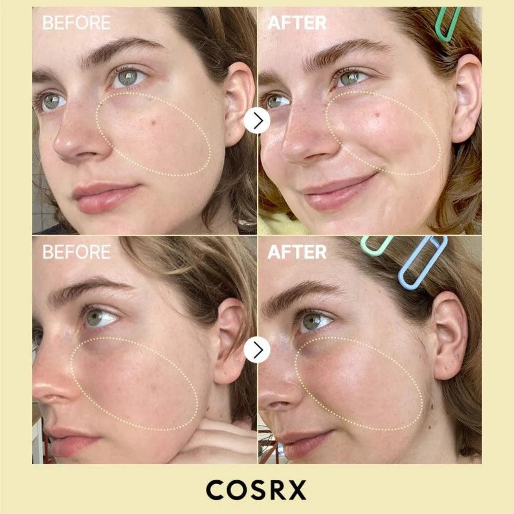 COSRX The Vitamin C 23