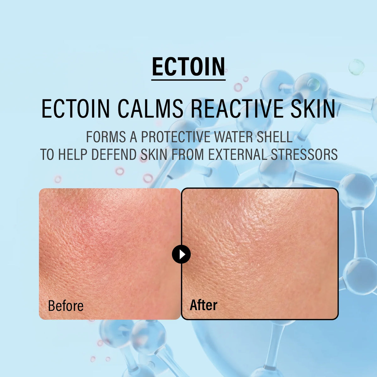 epii Double Up Cream Ectoin & Panthenol