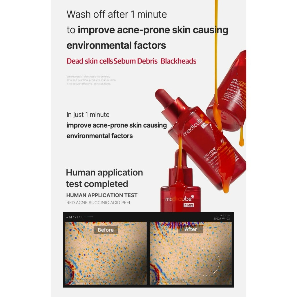 Medicube Red Acne Succinic Acid Peel 40g